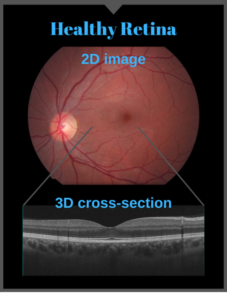 Digital Retinal Imaging - Greenfield Optometry