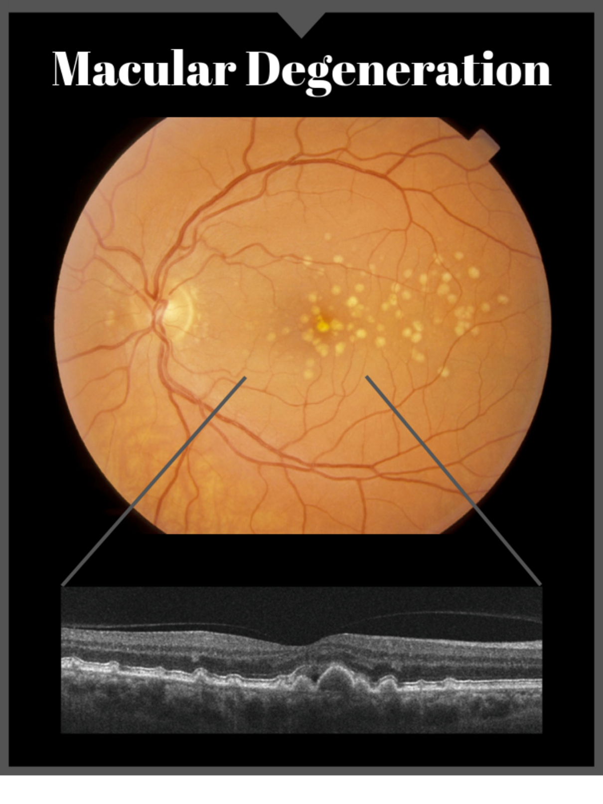 Digital Retinal Imaging Greenfield Optometry